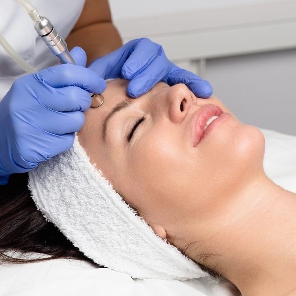 Microdermabrasion (Add On)