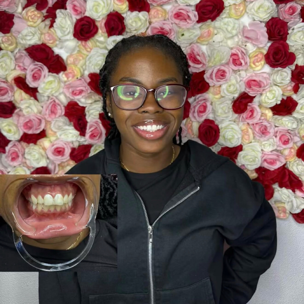 90min (Best Results) at Luxe Glow Smiles in orlando, FL