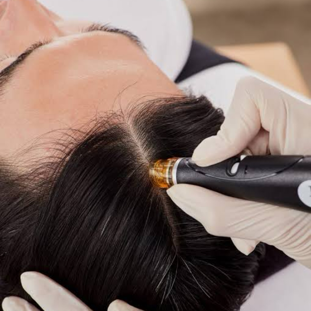 Keravive Scalp Treatment at Amethyst | The Head Spa in Shreveport, LA