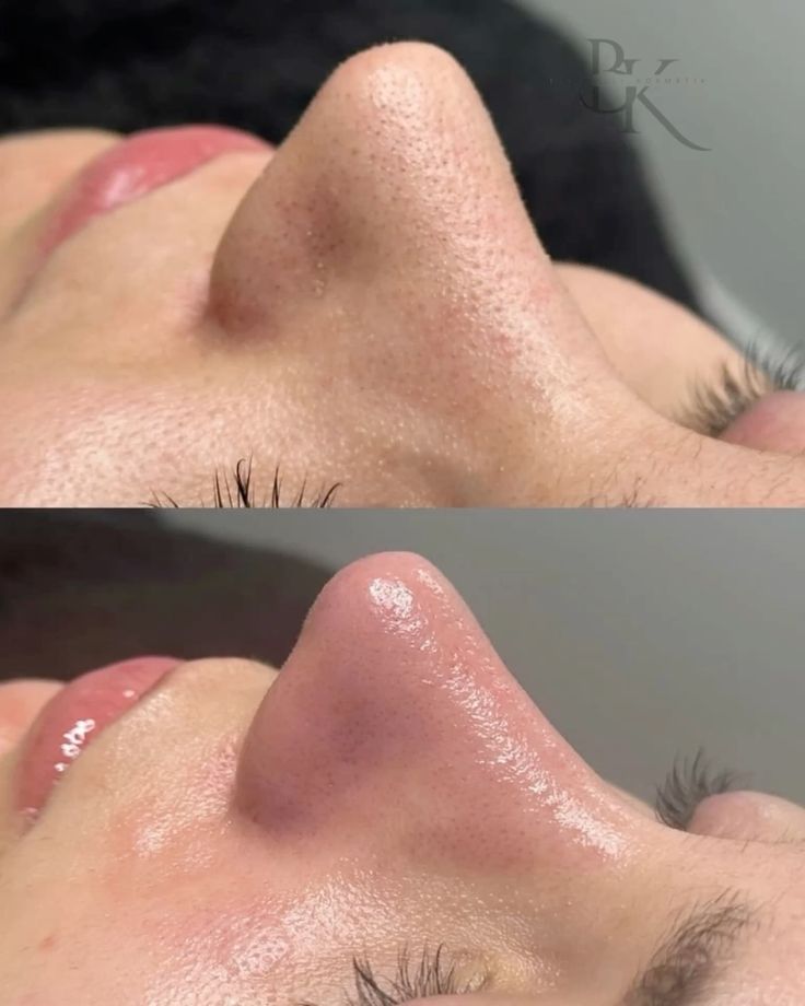 Deep Pore Cleansing Facial