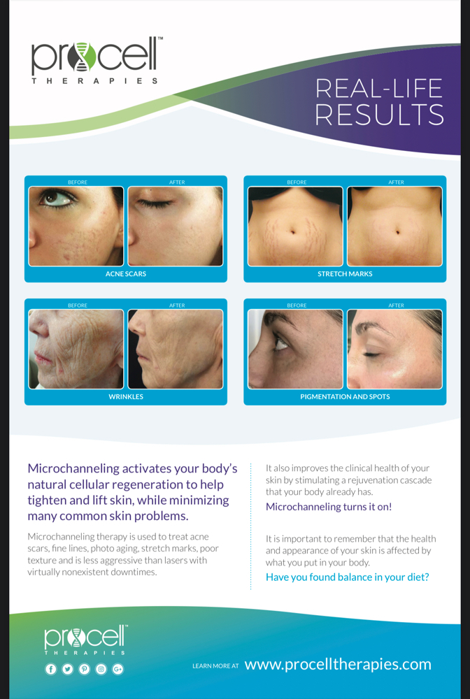 Procelle Microchanneling MD Serum at Dr. House Beauty Spa in Orland Park, IL