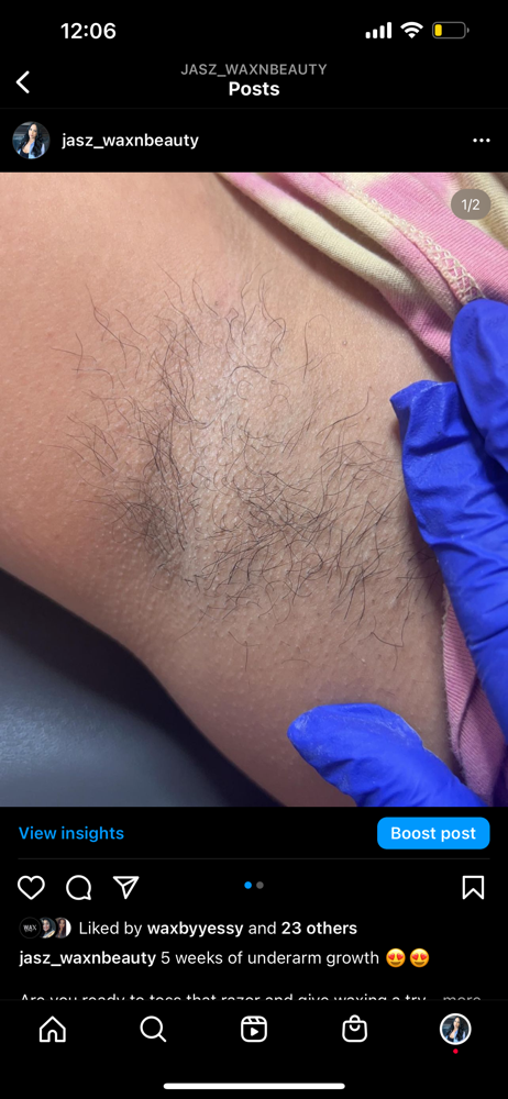 Underarm
