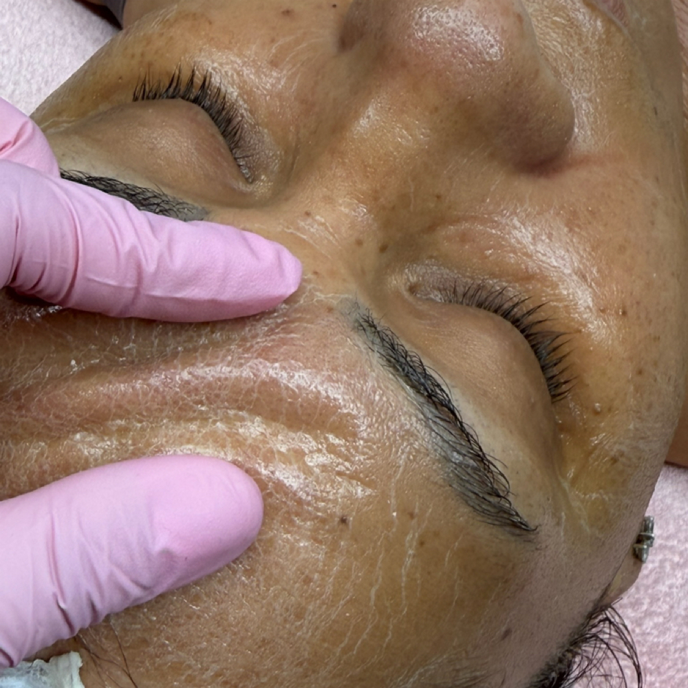 Chemical Peel Personalized at Lash Co. in Spring Hill, FL