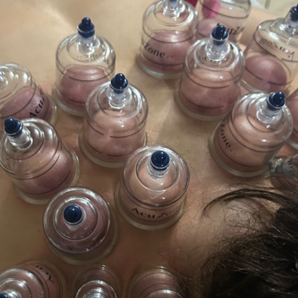 Dry Cupping Therapy - Full back at Savage Beauty Brows ✨ in National City, CA