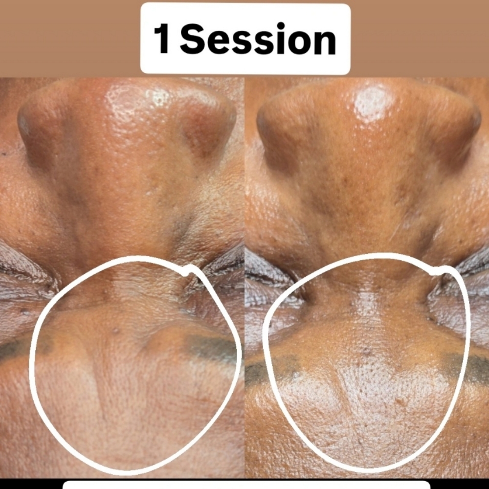 Microcurrent Anti-Aging Facial at Basic and Beyond Brows in Lakewood, CA
