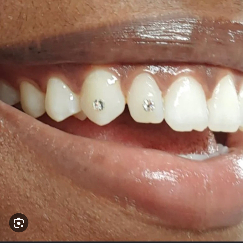 Tooth Gem - 1