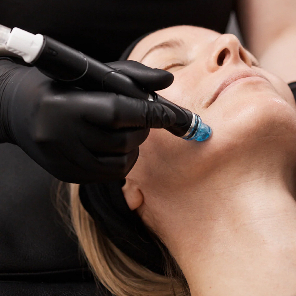 Deep Cleansing Hydrofacial's at Orion Beauty in Cincinnati, OH