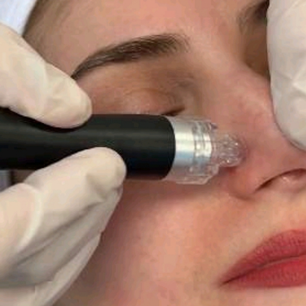 Hydrodermabrasion Platinum Facial at Entouch Day Spa  |   La Pine's Premier Facial Spa & Waxing Studio in La Pine, OR