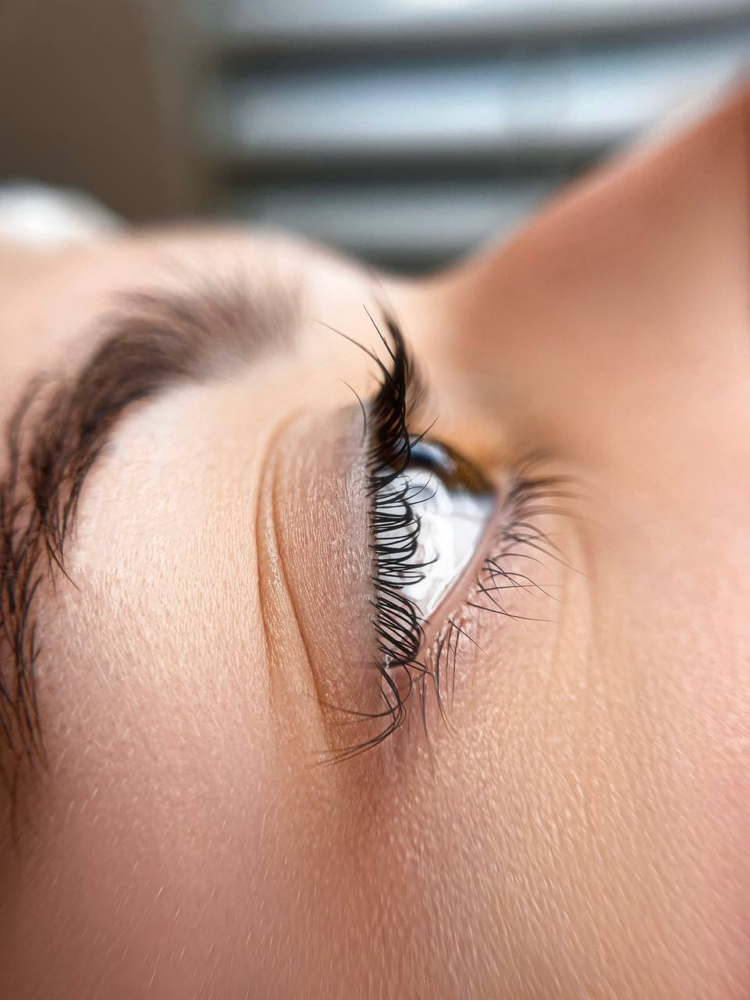 Eyelash Removal at Dina Staroverova in Fair Oaks, CA