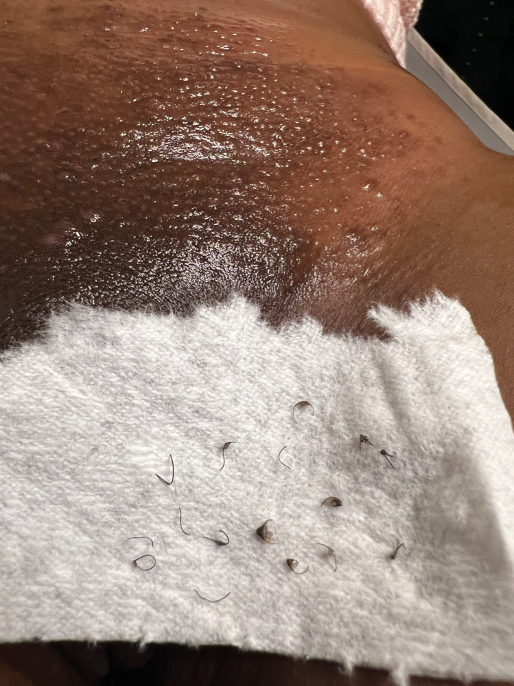 Hard Wax W/ Extractions