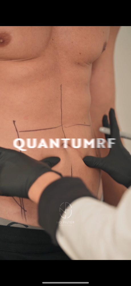 Quantom RF