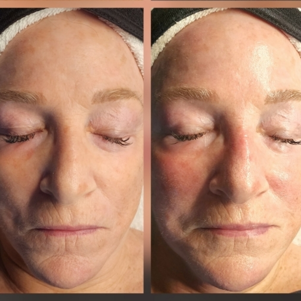 Deluxe Custom Facial at Boho Beauty Studio in Grants Pass, OR