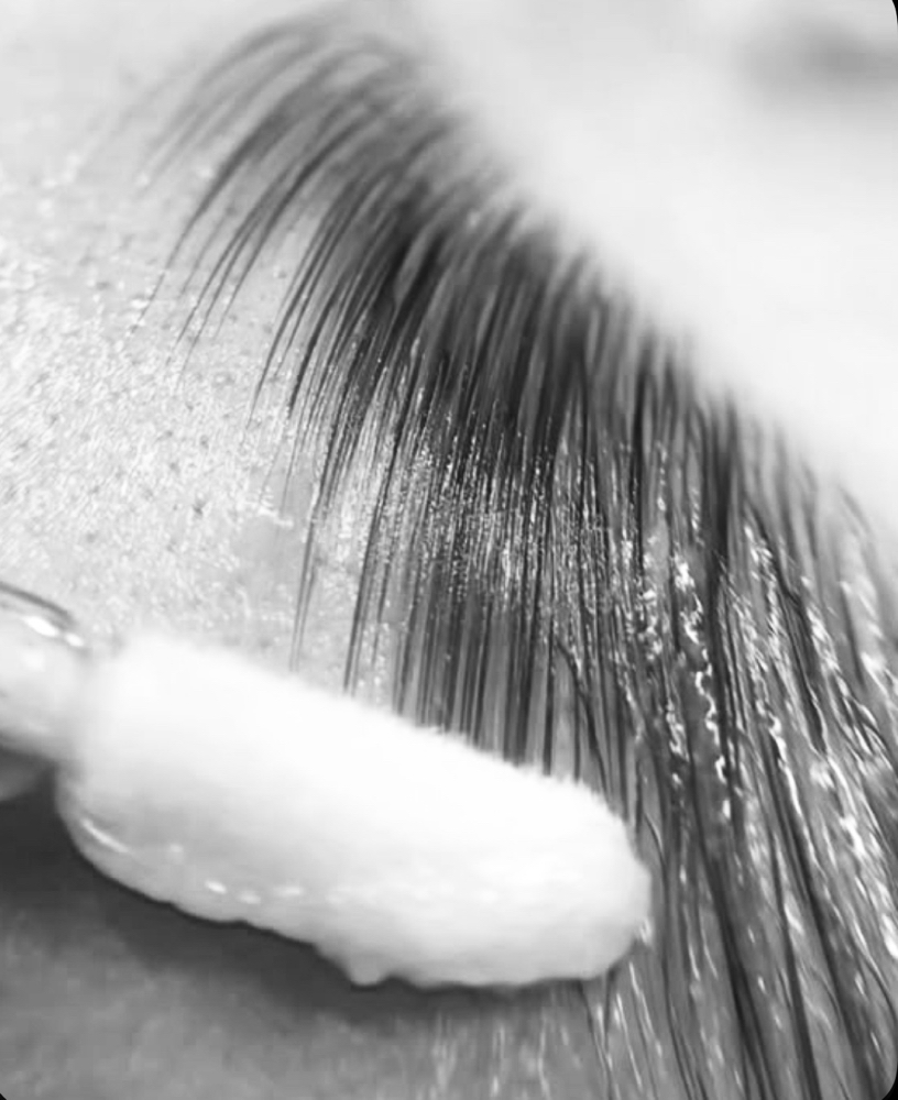 Partial Lamination (Front Cowlick)