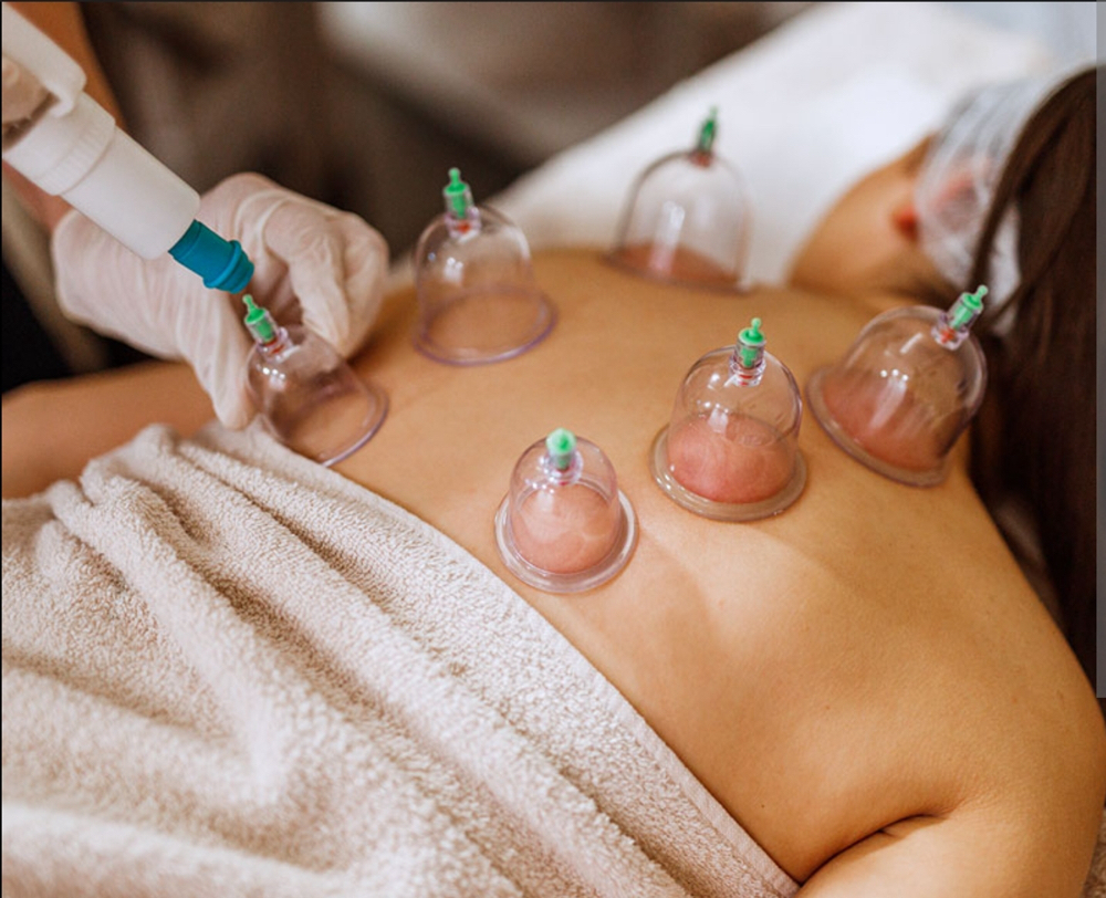 Cupping Add On No Additonal Charge