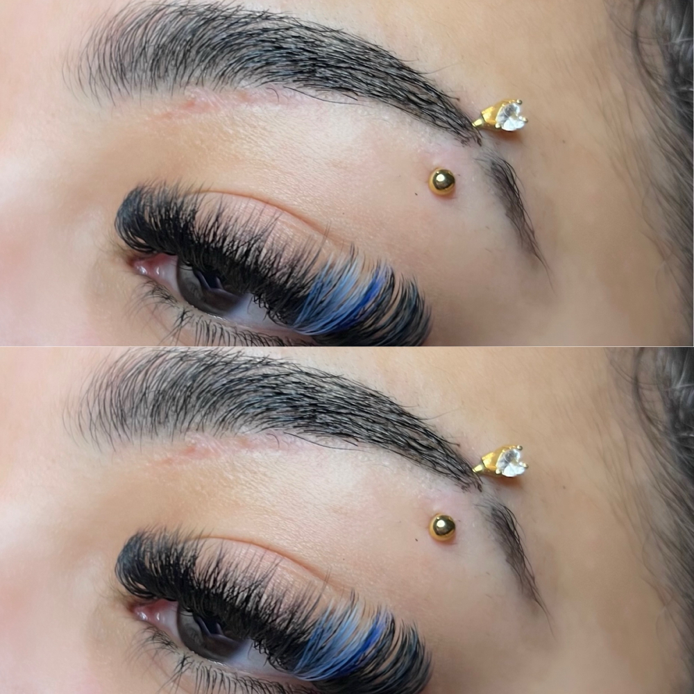 Brow Enhancements