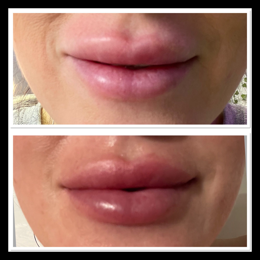 🎀Lip Flip