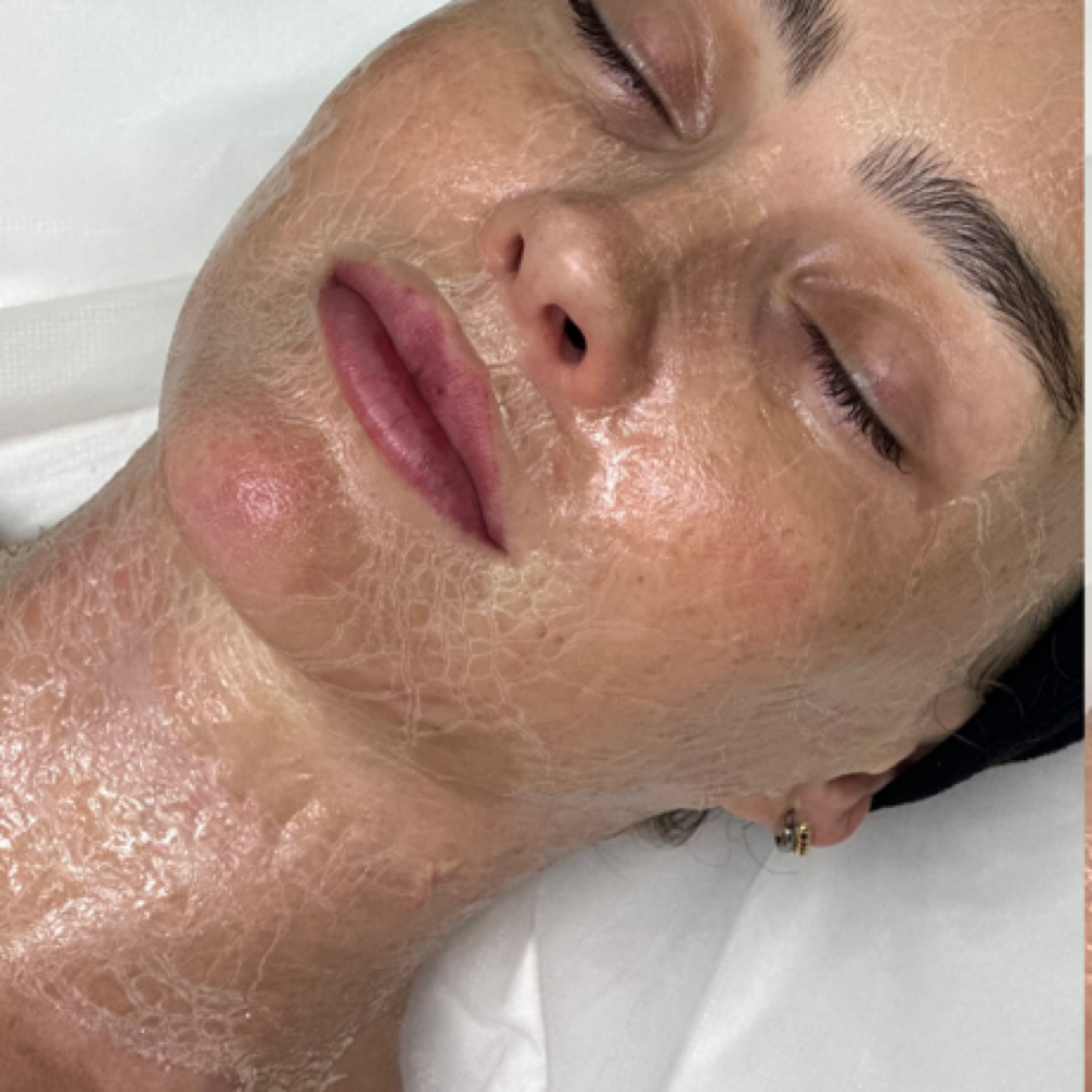 The Beyond Botox Facial Treatment at Ali Parker Beauty in Eufaula, AL