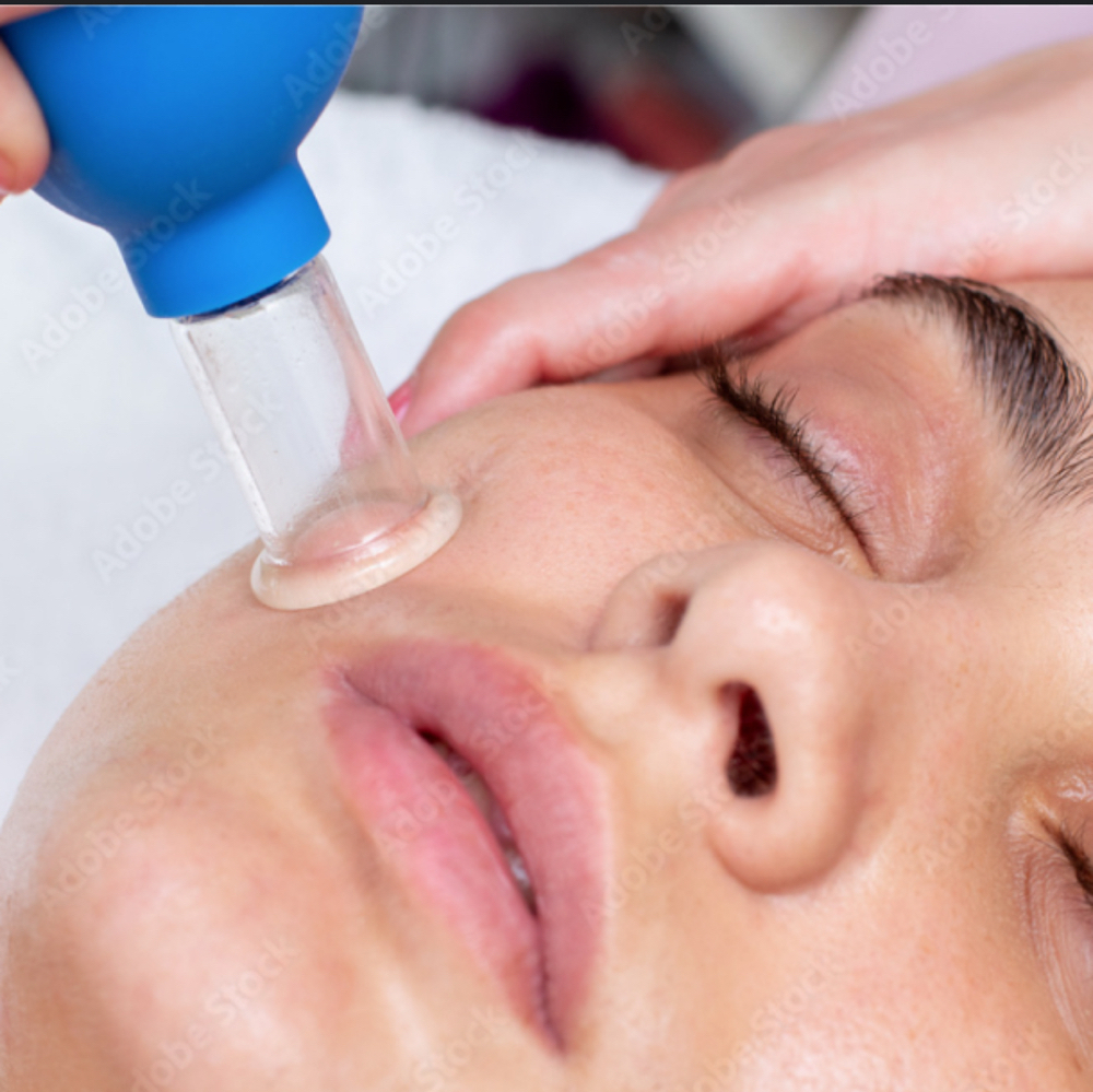 Facial Cupping