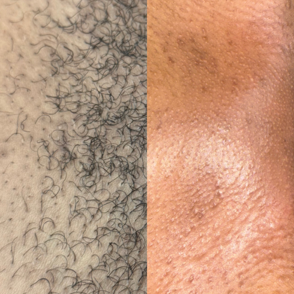 New Client Brazilian Wax at Xtreme Lush Skin in Houston, TX