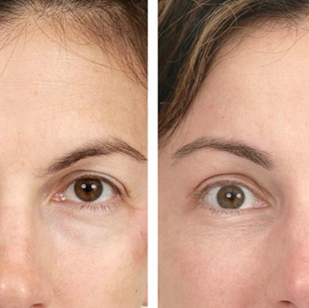 Brow Lift at Bliss Beauty Bar in Houston, TX