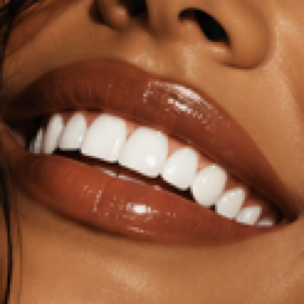 Touch Up Treatment at Afterglo Organic Teeth Whitening East in Milwaukee, WI