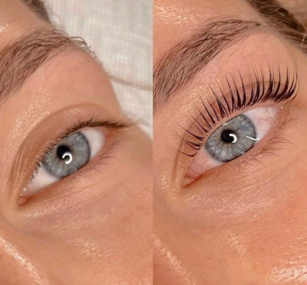 Eyelash Lift