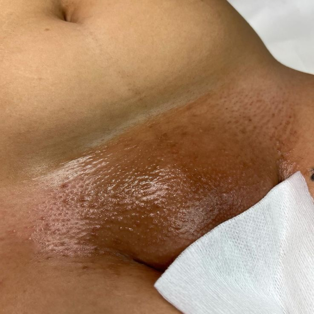 Brazilian (7+ Weeks) at GlowedByMari in Houston, TX