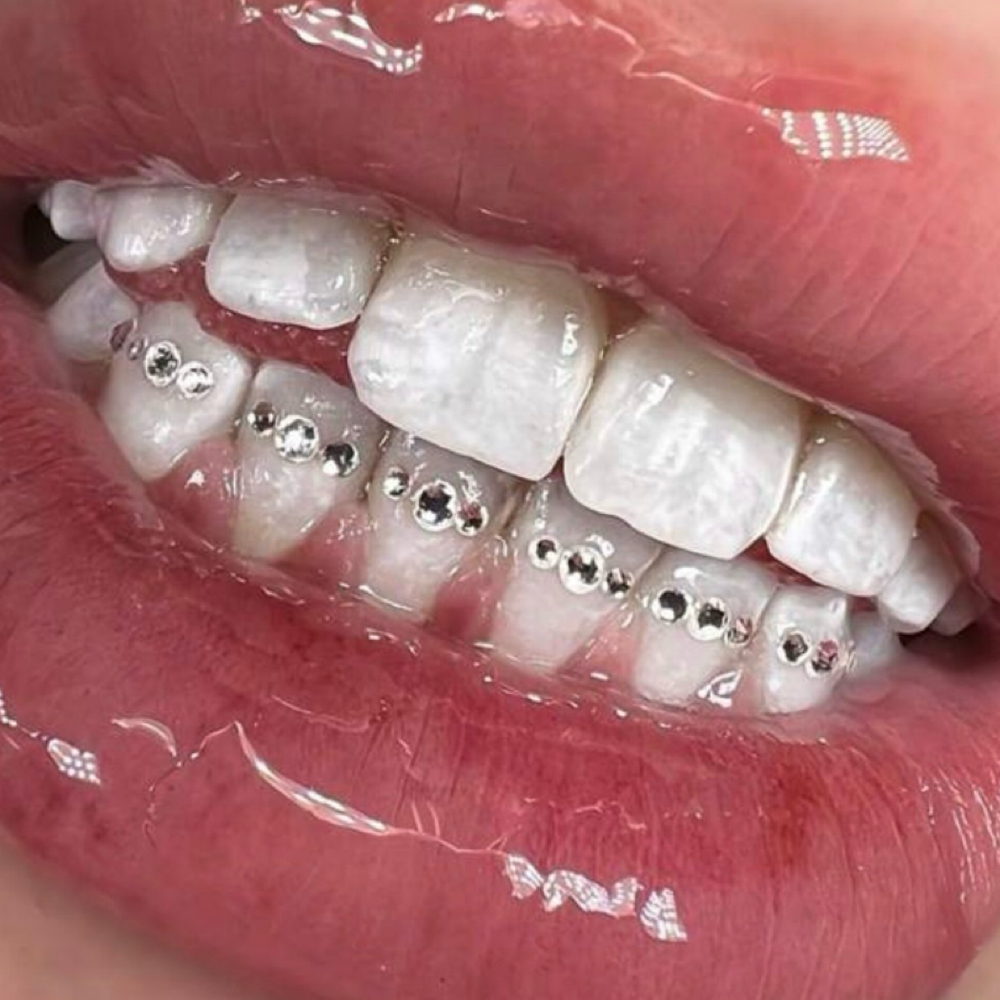 Tooth Gem Application Tooth Outline at Icey Whites By Blondee in Lawrence, MA