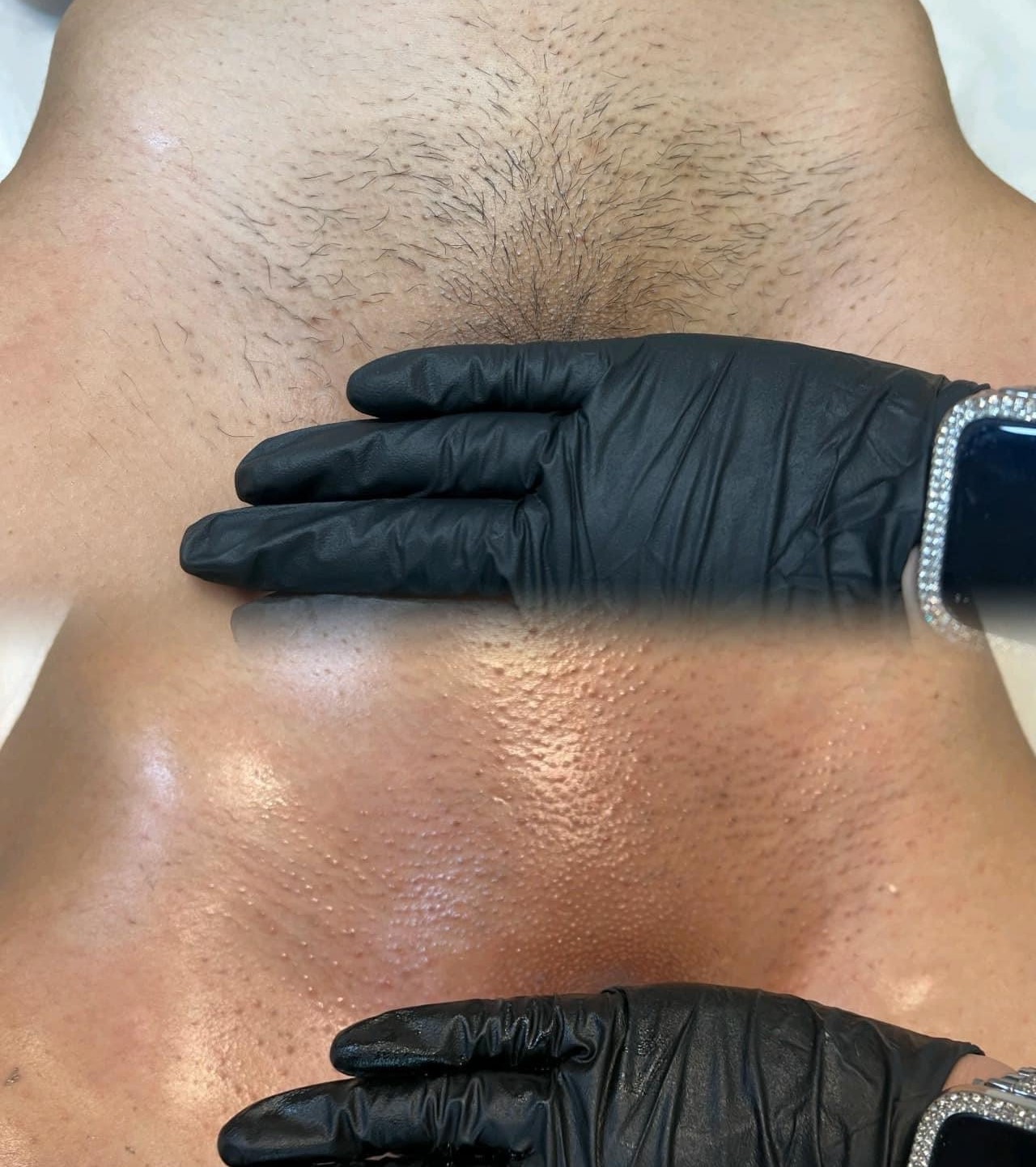 Brazilian Wax