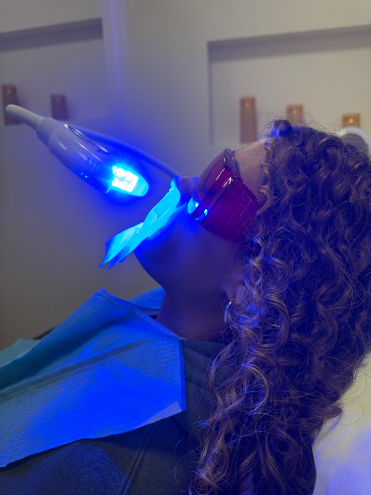 Teeth Whitening