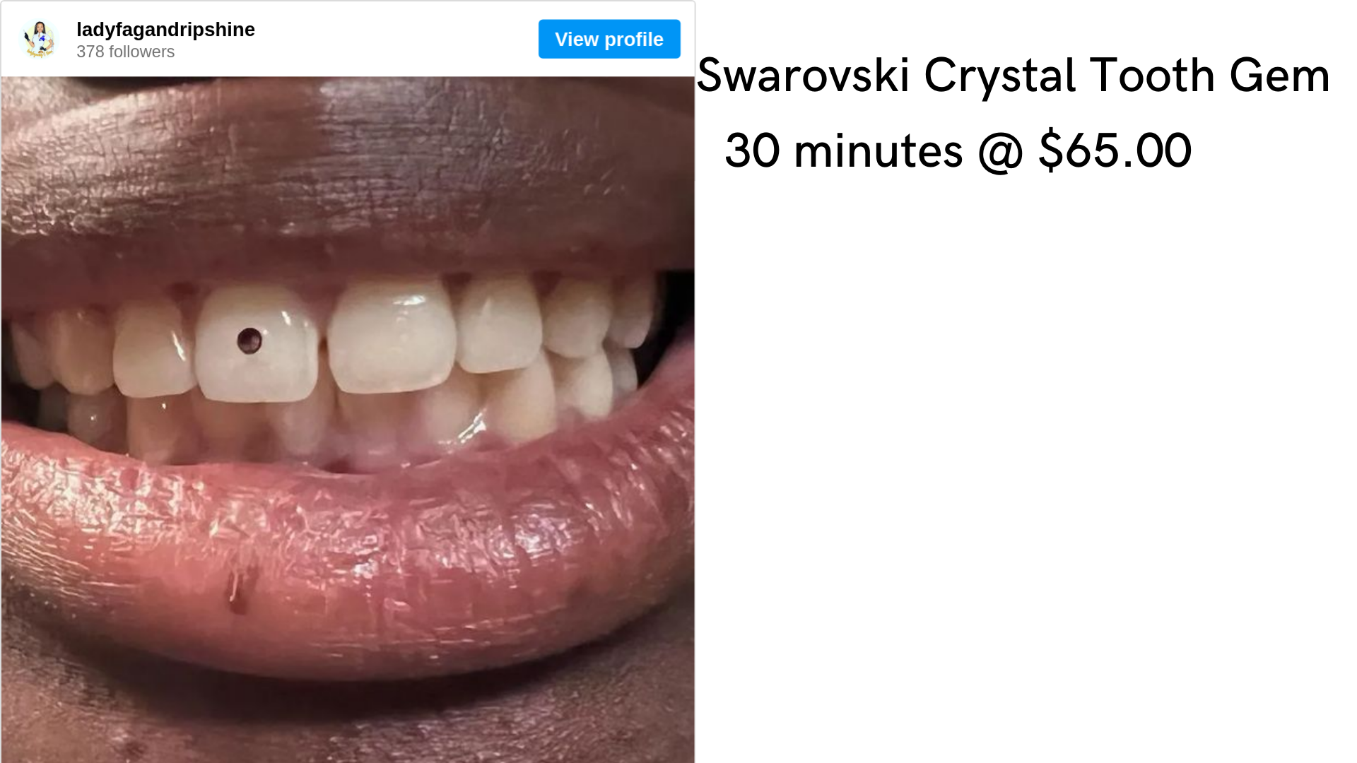 Swarovski Crystal Tooth Gem