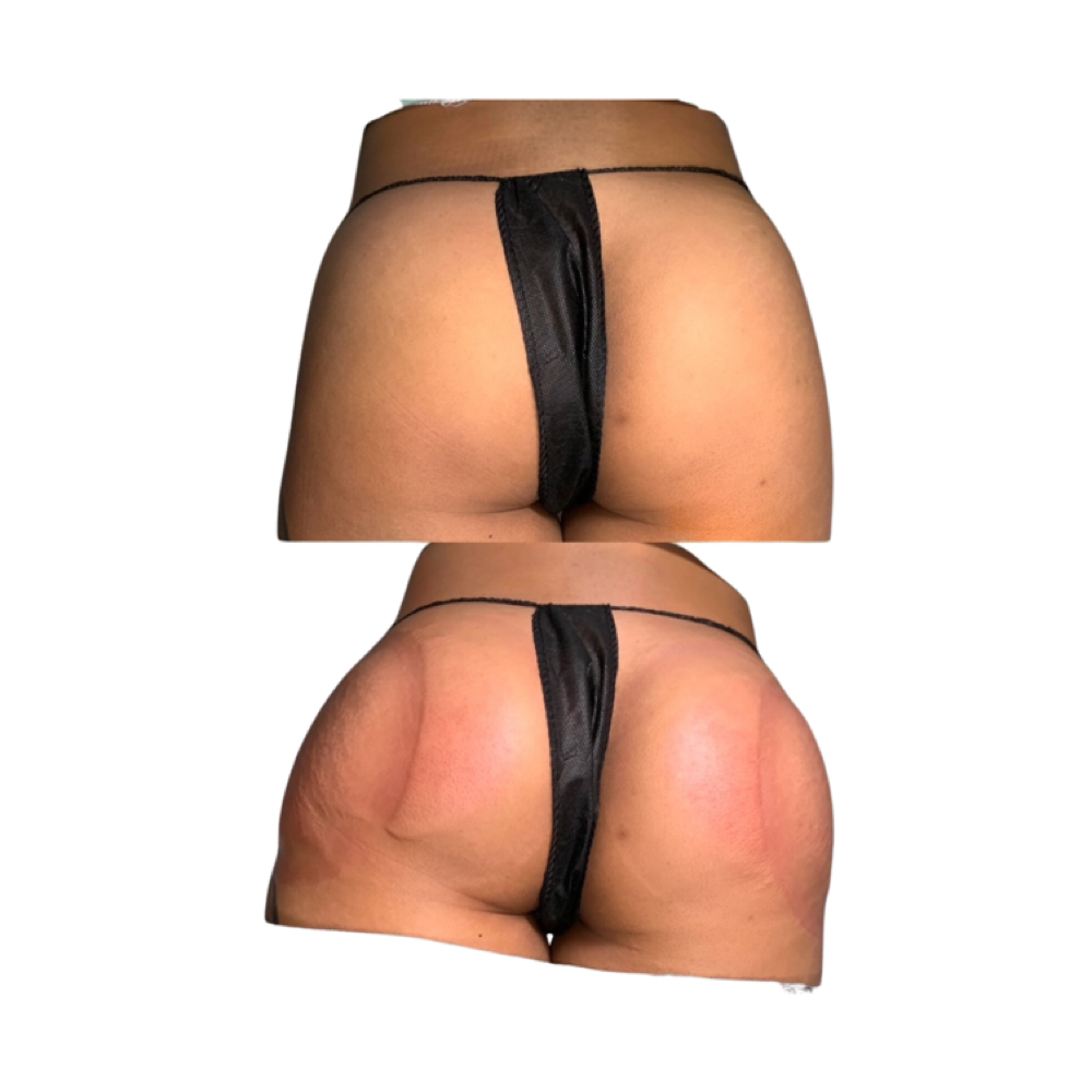 B00TY B0UNCE V0L. 1ᴺᴶ at MONMOUTH COUNTYᴺᴶ ✧ 1ST TOOTH JEWELER ↯ #POPURWAXINCHERRY🫟 in Hazlet, NJ