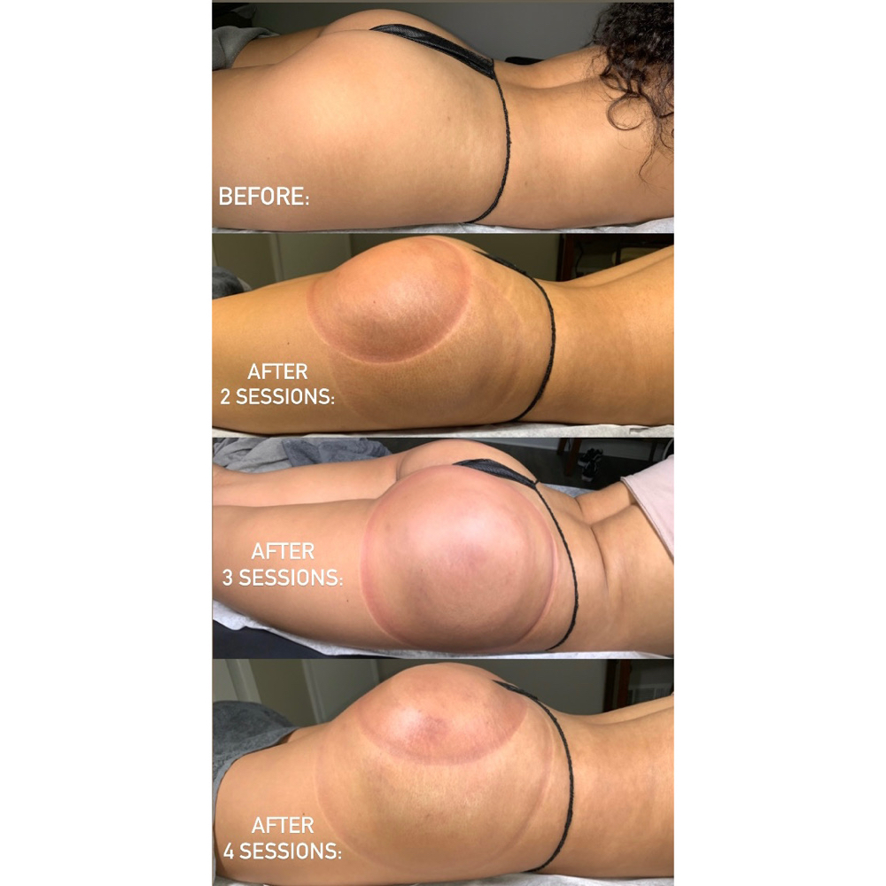 👻 1️⃣ BOOOTY Enhancement