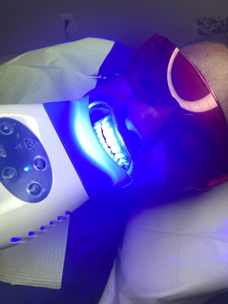 Teeth Whitening at Eximius Bella in Garner, NC