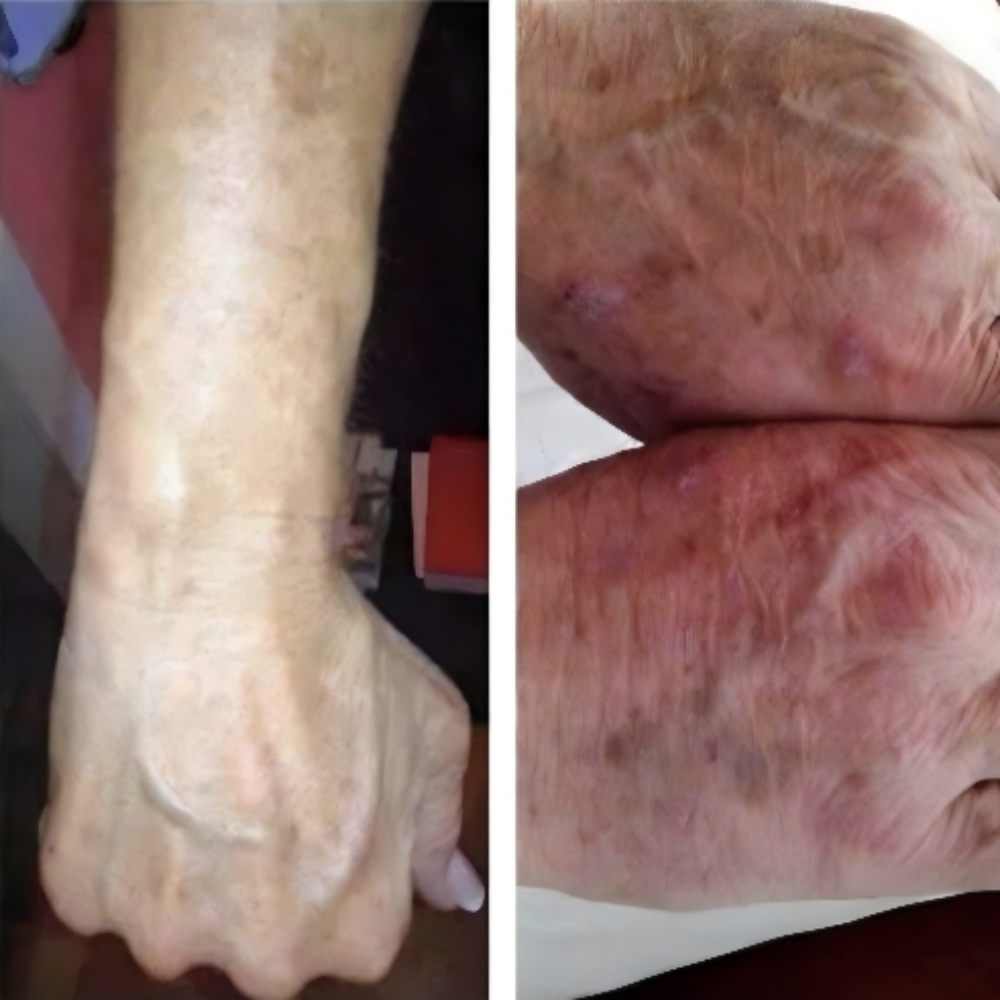 2 Hand Rejuvenation Bundle Of 2