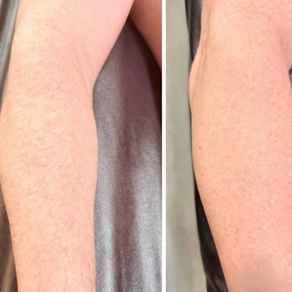 Full Arm Wax (Male) at H2 Beauty LLC in The Village, OK