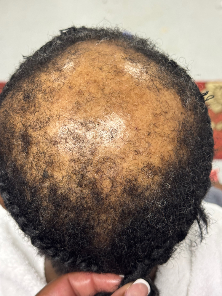 Alopecia Crochet at Oyintare Hair ATL in Fayetteville, GA