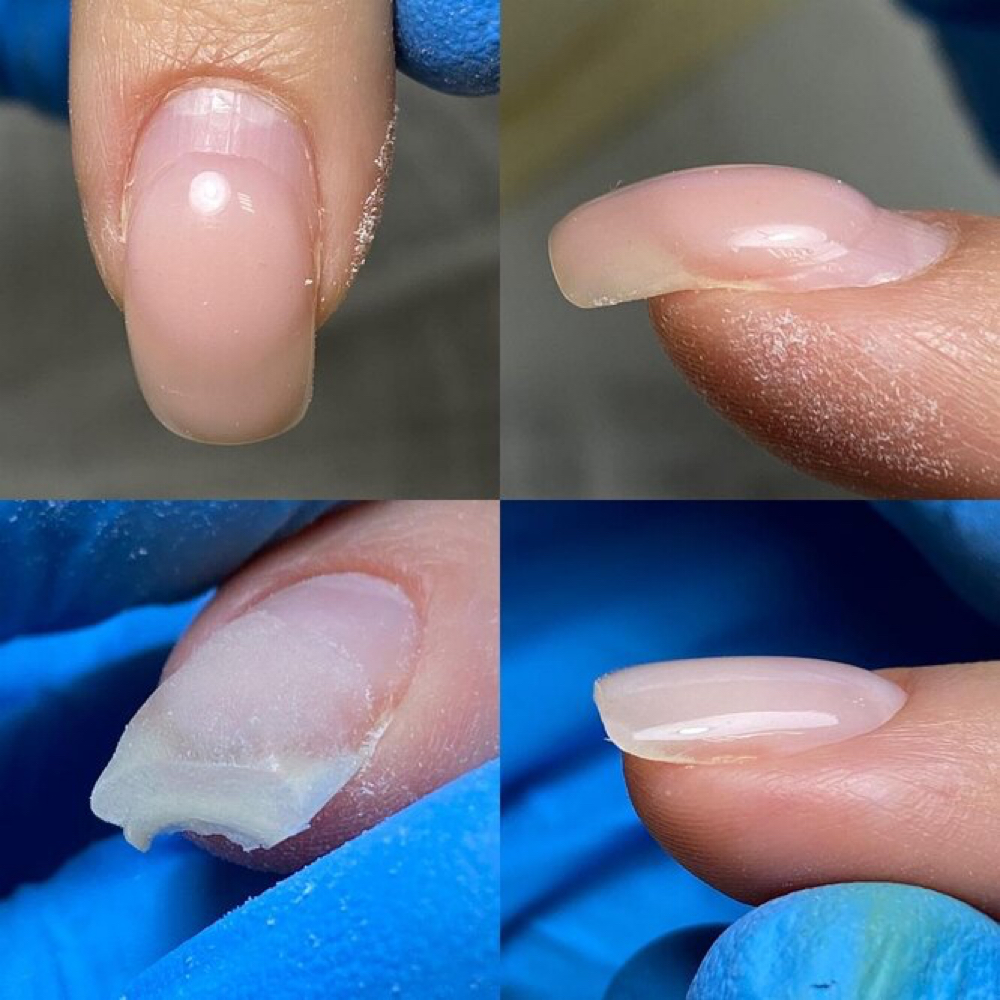 Nail Correction (Long Nails) at Aesthetic Cuticles in Scottsdale, AZ