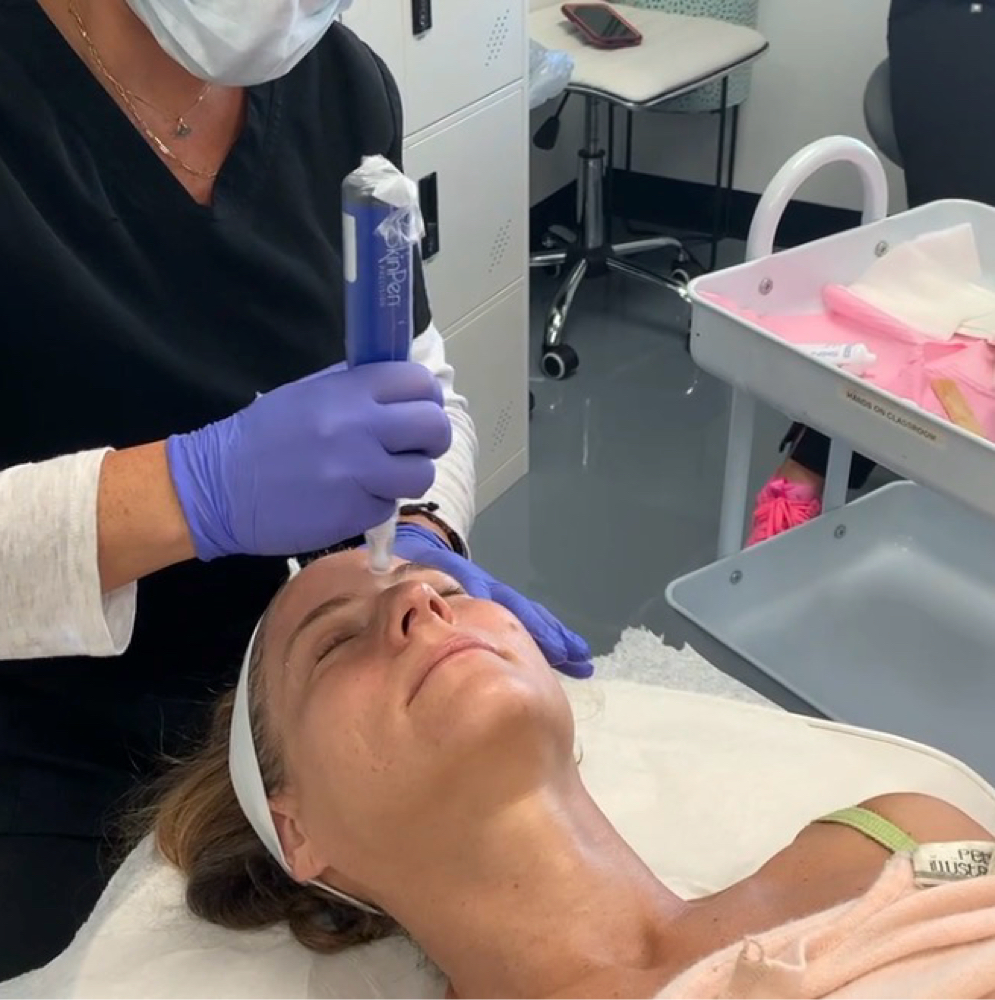 Micrineedle/ Dermaplaning at L A BEAUTY STUDIO in Lakeway, TX