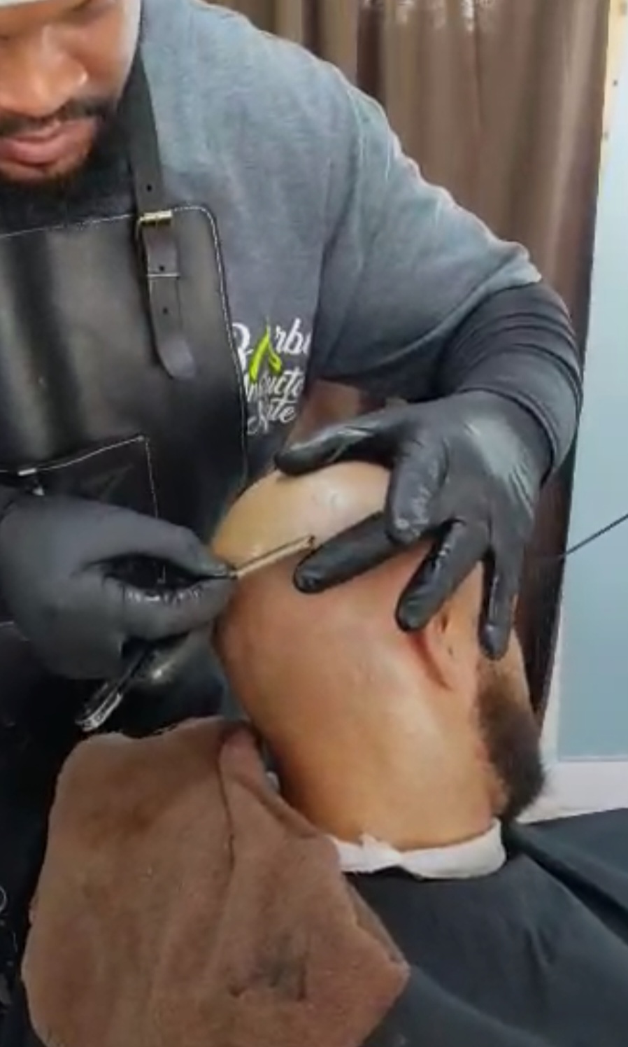 Micro Balding