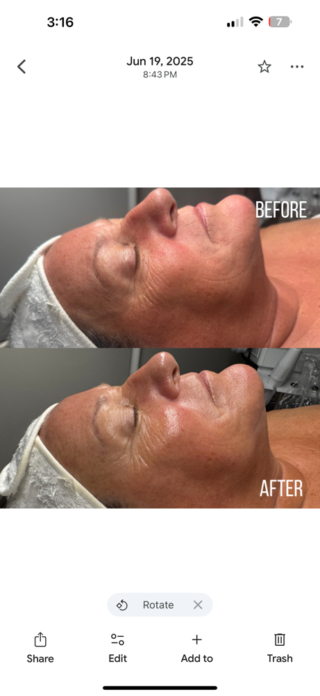 Restorative Facial