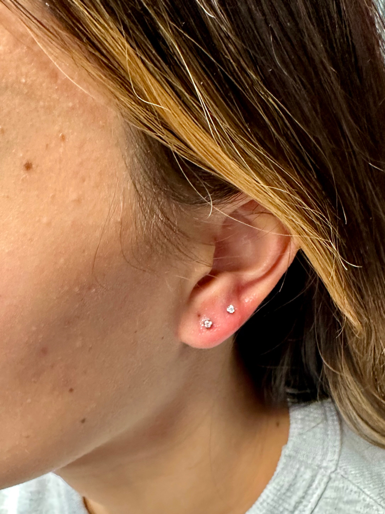 Lobe Set piercing