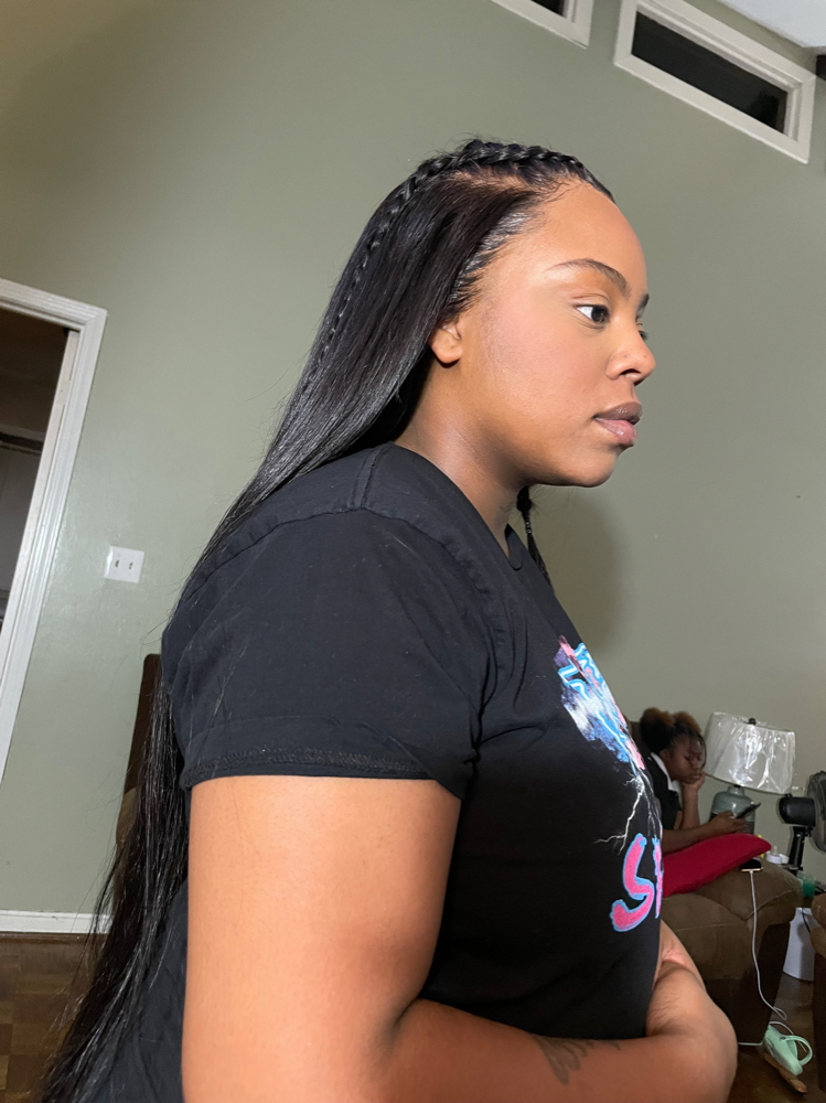 Frontal Wig