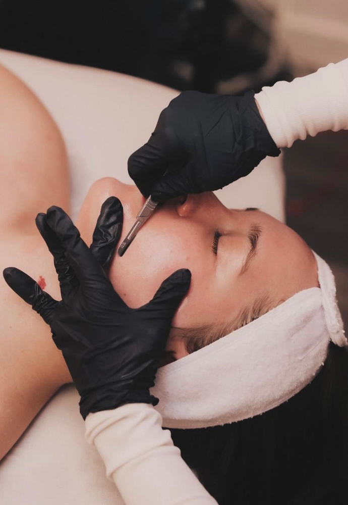 Dermaplaning Facial