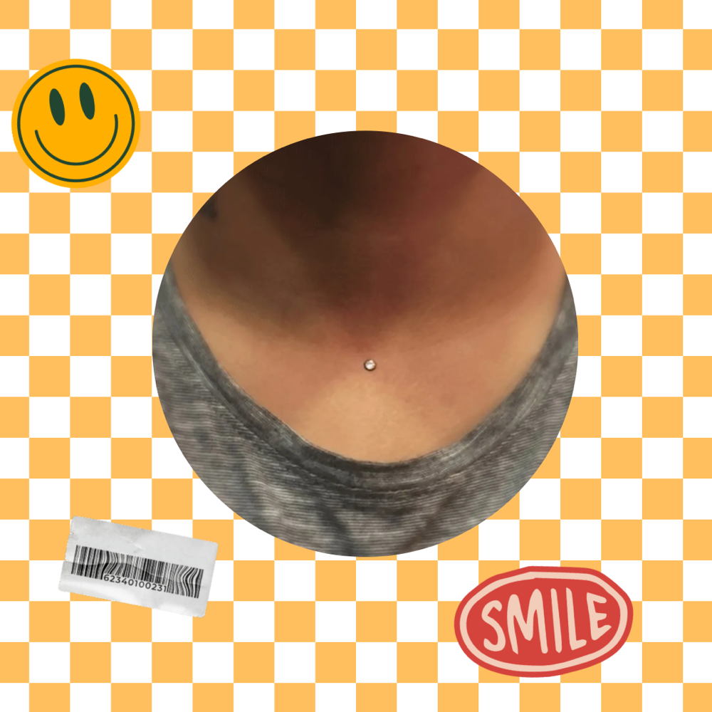 Single Dermal