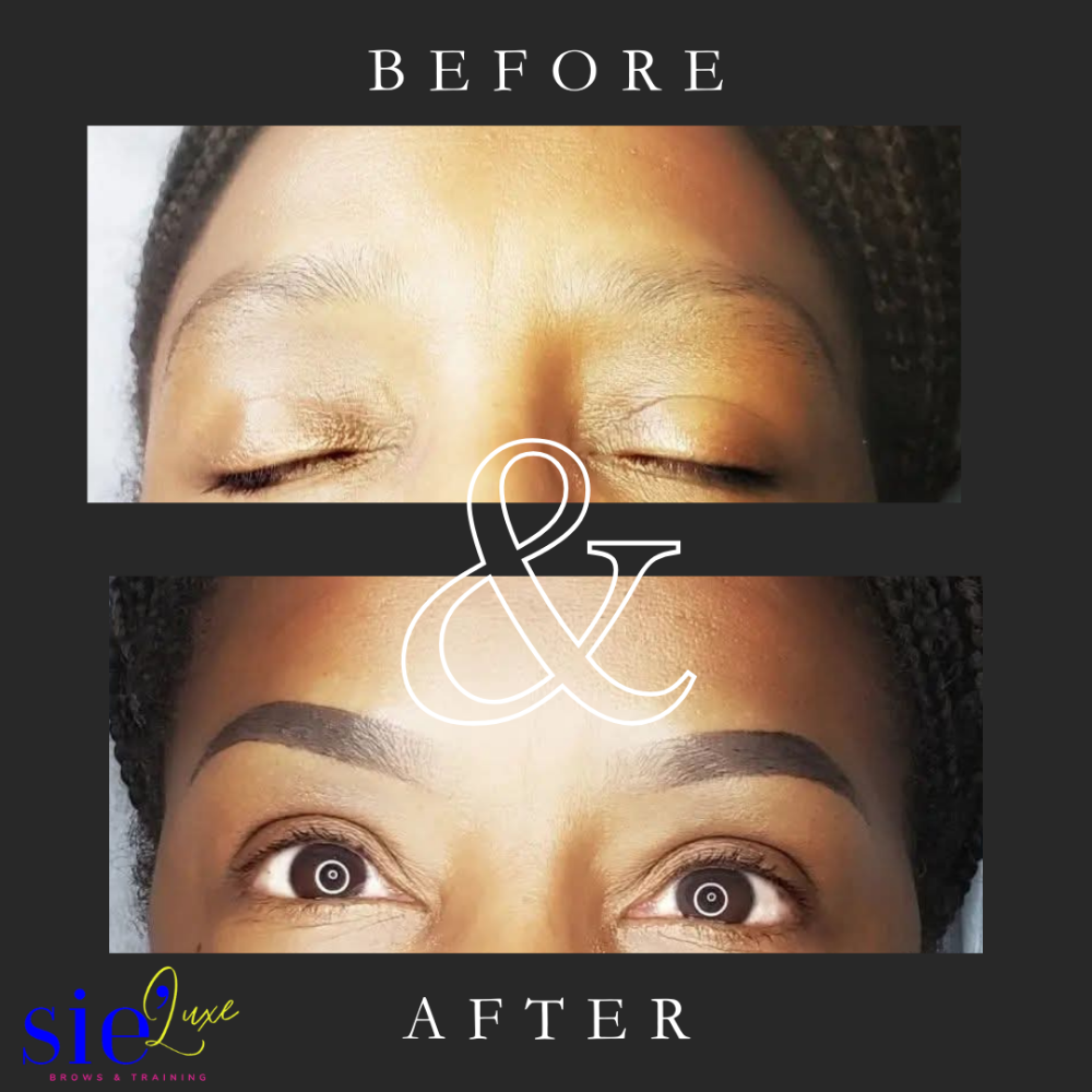Follow-up Touchup (6-8 Weeks)