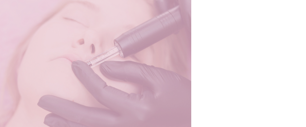 Microneedling With RF