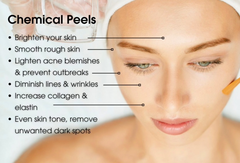 Level 1- Sanitas Lactic Peel