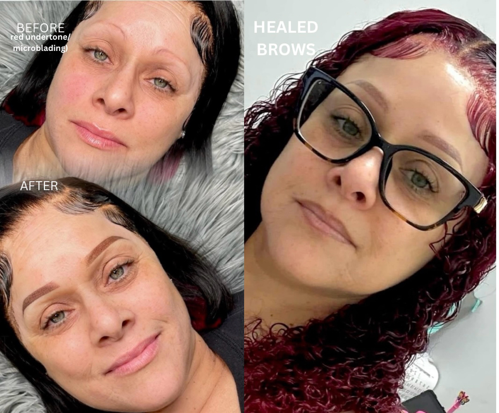 Correction Brows