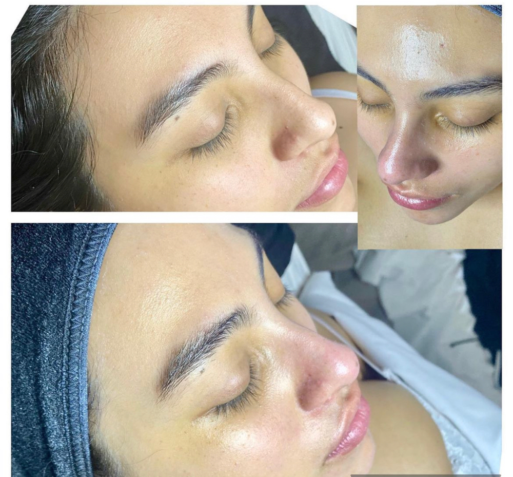 Glow and Go Facial